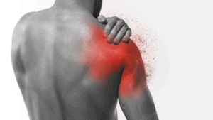 shockwave therapy for shoulder calcification