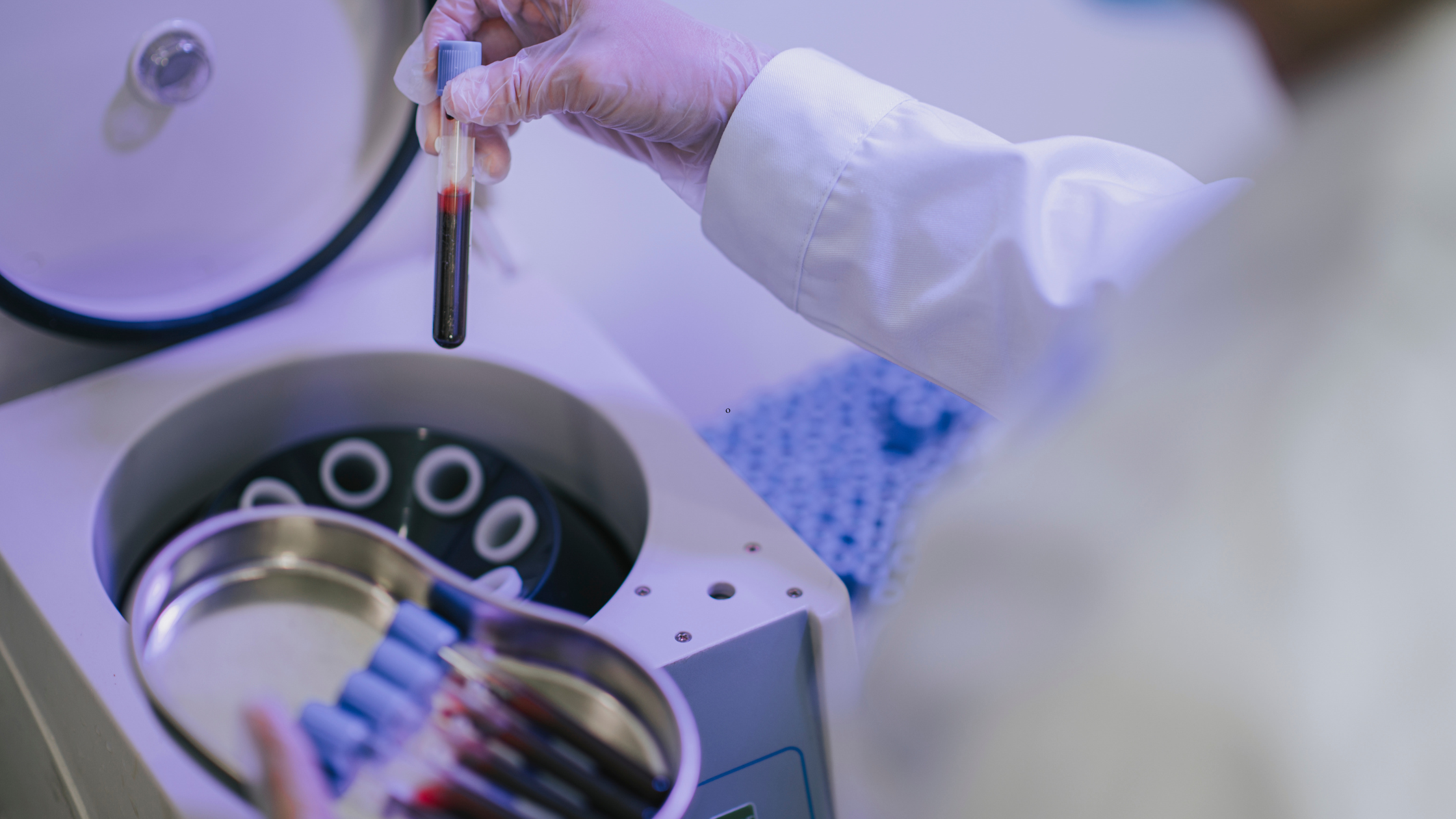 PRP and stem cell therapy